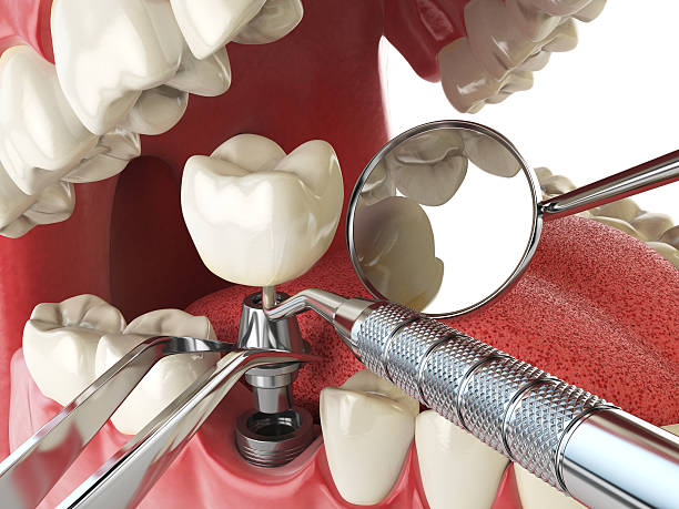 Best Walk-In Emergency Dental Services in Springdale, PA